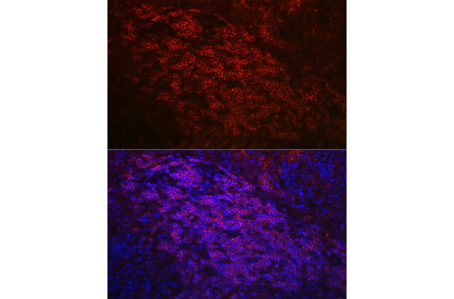 Immunofluorescence - Anti-CD79a Antibody (A8388) - Antibodies.com