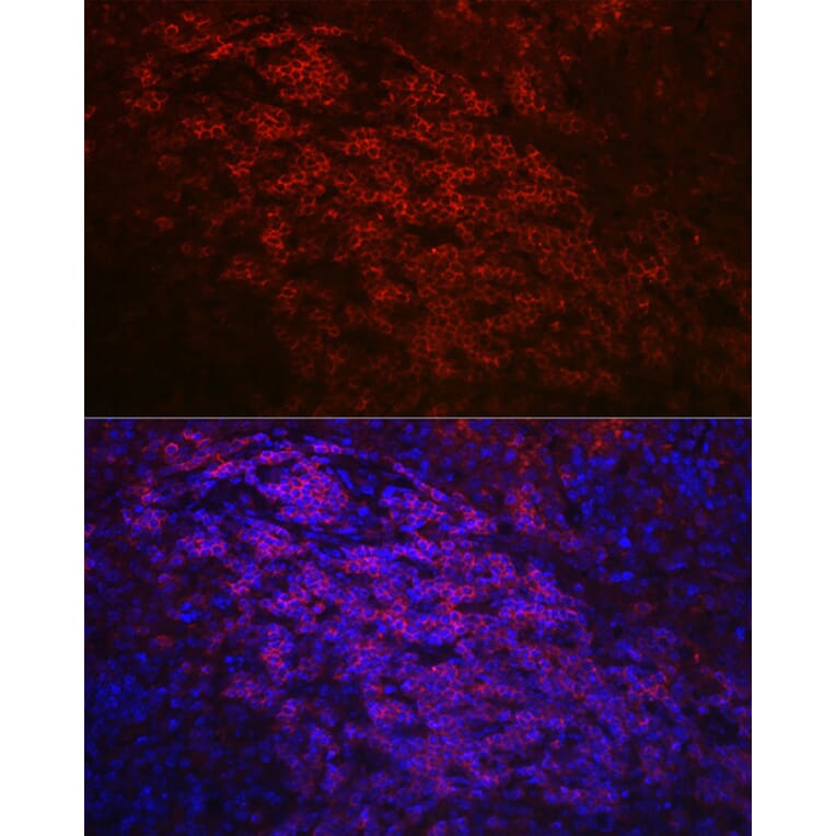 Immunofluorescence - Anti-CD79a Antibody (A8388) - Antibodies.com