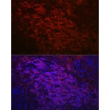 Immunofluorescence - Anti-CD79a Antibody (A8388) - Antibodies.com