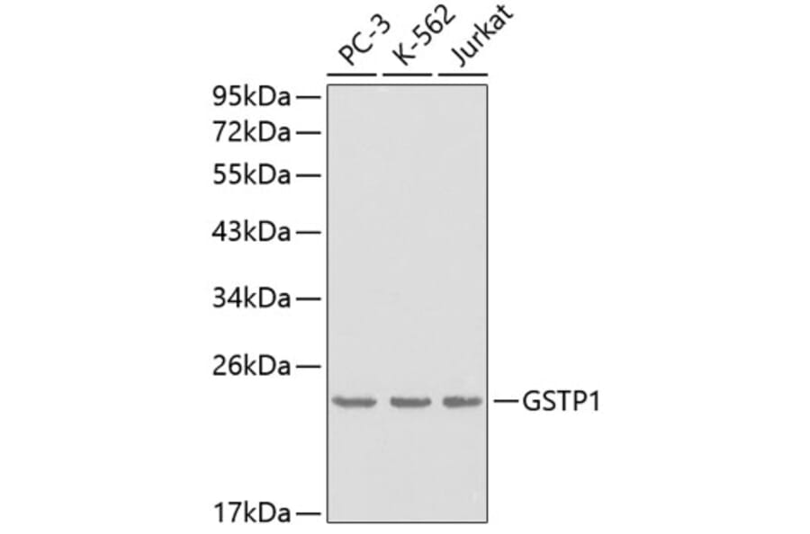 Western Blot - Anti-GSTP1 Antibody (A0348) - Antibodies.com