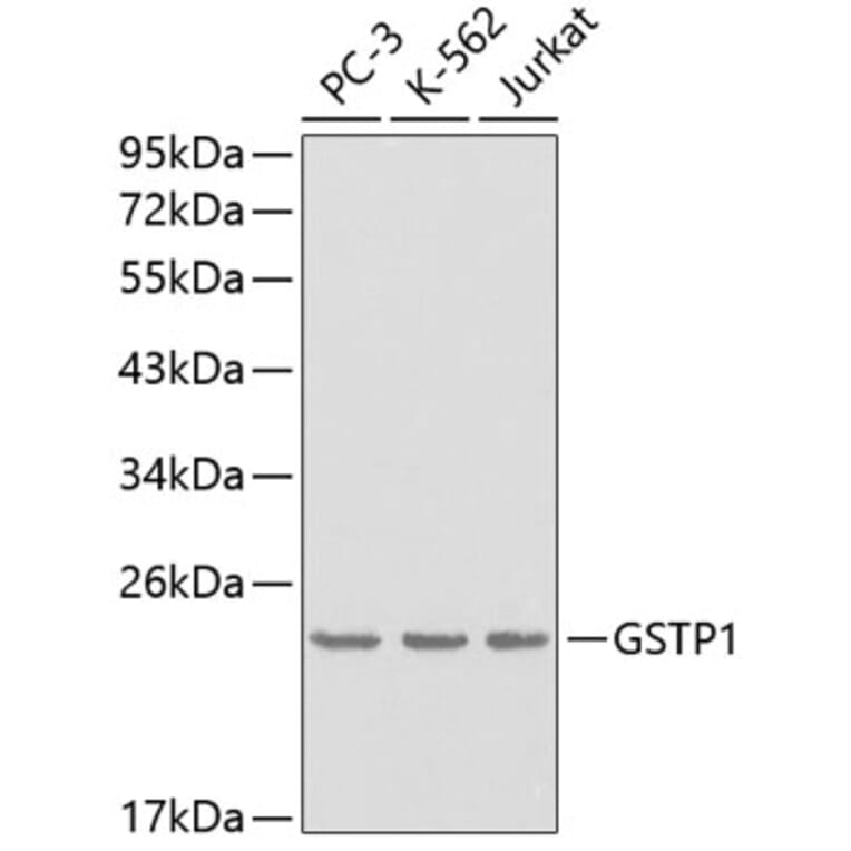 Western Blot - Anti-GSTP1 Antibody (A0348) - Antibodies.com