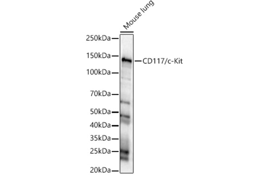 Western Blot - Anti-c-Kit Antibody (A8390) - Antibodies.com