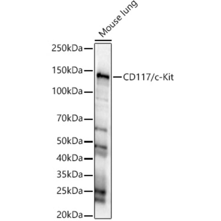 Western Blot - Anti-c-Kit Antibody (A8390) - Antibodies.com
