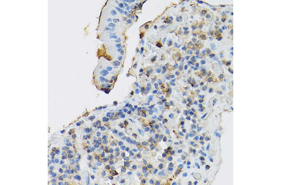 Immunohistochemistry - Anti-c-Kit Antibody (A8390) - Antibodies.com