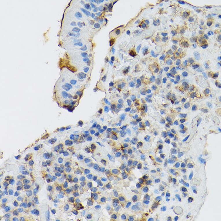 Immunohistochemistry - Anti-c-Kit Antibody (A8390) - Antibodies.com