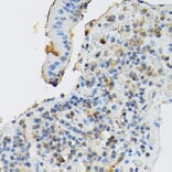 Immunohistochemistry - Anti-c-Kit Antibody (A8390) - Antibodies.com