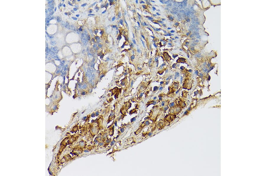 Immunohistochemistry - Anti-c-Kit Antibody (A8390) - Antibodies.com