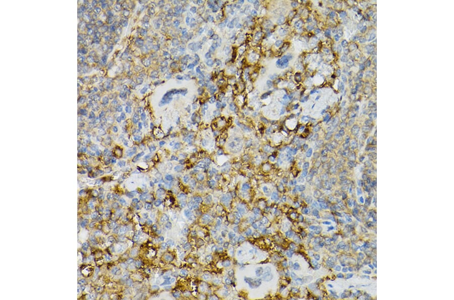 Immunohistochemistry - Anti-c-Kit Antibody (A8390) - Antibodies.com