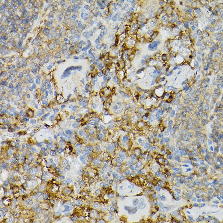 Immunohistochemistry - Anti-c-Kit Antibody (A8390) - Antibodies.com