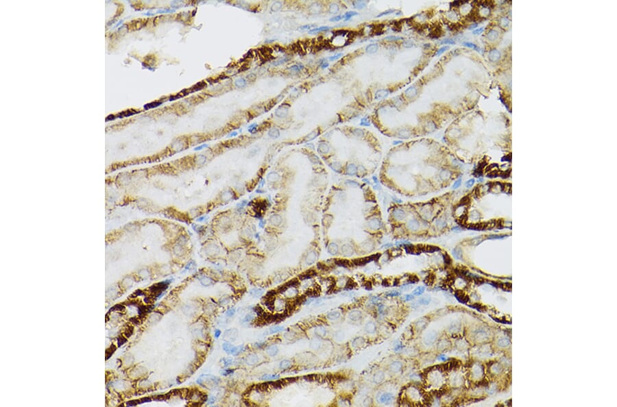 Immunohistochemistry - Anti-c-Kit Antibody (A8390) - Antibodies.com