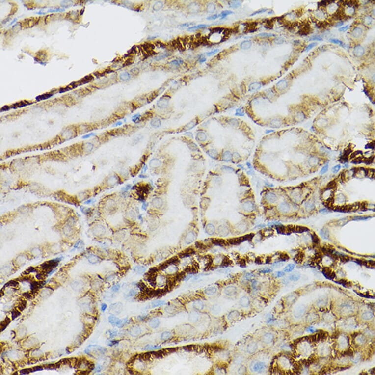 Immunohistochemistry - Anti-c-Kit Antibody (A8390) - Antibodies.com