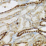 Immunohistochemistry - Anti-c-Kit Antibody (A8390) - Antibodies.com