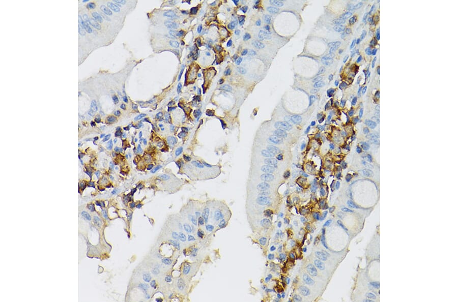 Immunohistochemistry - Anti-c-Kit Antibody (A8390) - Antibodies.com