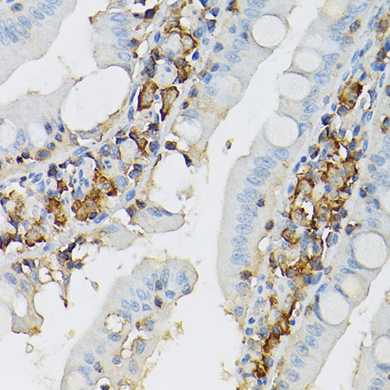 Immunohistochemistry - Anti-c-Kit Antibody (A8390) - Antibodies.com