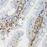 Immunohistochemistry - Anti-c-Kit Antibody (A8390) - Antibodies.com