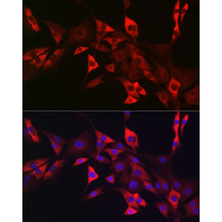 Immunofluorescence - Anti-c-Kit Antibody (A8390) - Antibodies.com
