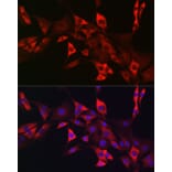 Immunofluorescence - Anti-c-Kit Antibody (A8390) - Antibodies.com