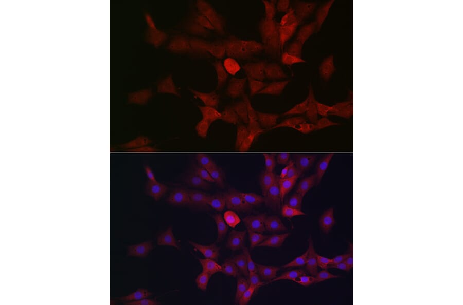 Immunofluorescence - Anti-c-Kit Antibody (A8390) - Antibodies.com