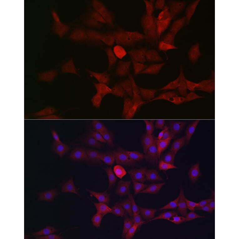 Immunofluorescence - Anti-c-Kit Antibody (A8390) - Antibodies.com