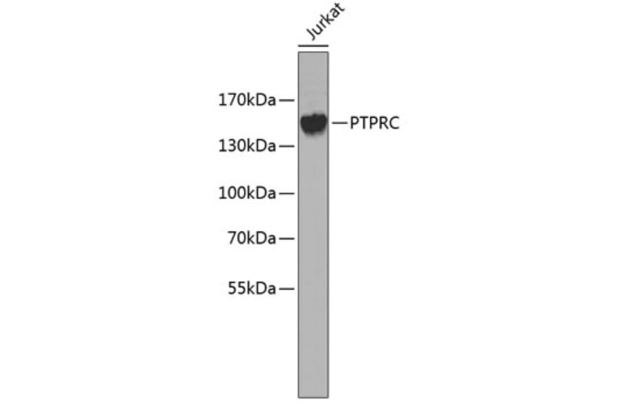 Western Blot - Anti-PTPRC Antibody (A0371) - Antibodies.com