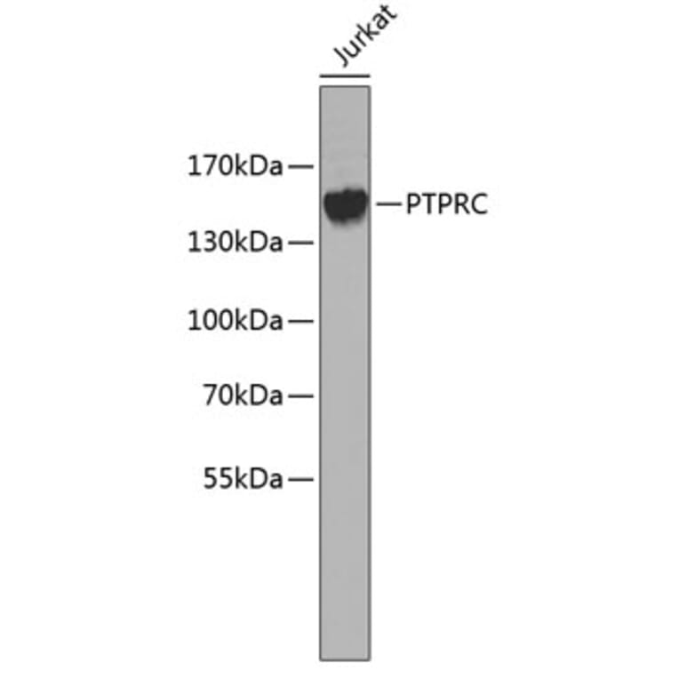 Western Blot - Anti-PTPRC Antibody (A0371) - Antibodies.com