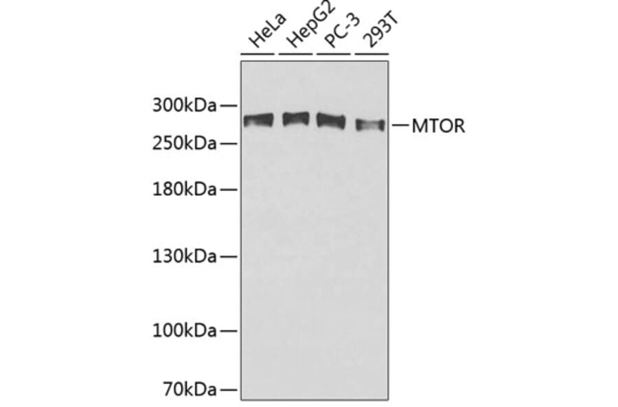 Western Blot - Anti-mTOR Antibody (A0380) - Antibodies.com