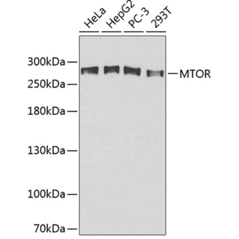 Western Blot - Anti-mTOR Antibody (A0380) - Antibodies.com