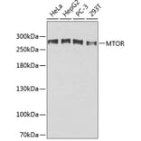 Western Blot - Anti-mTOR Antibody (A0380) - Antibodies.com