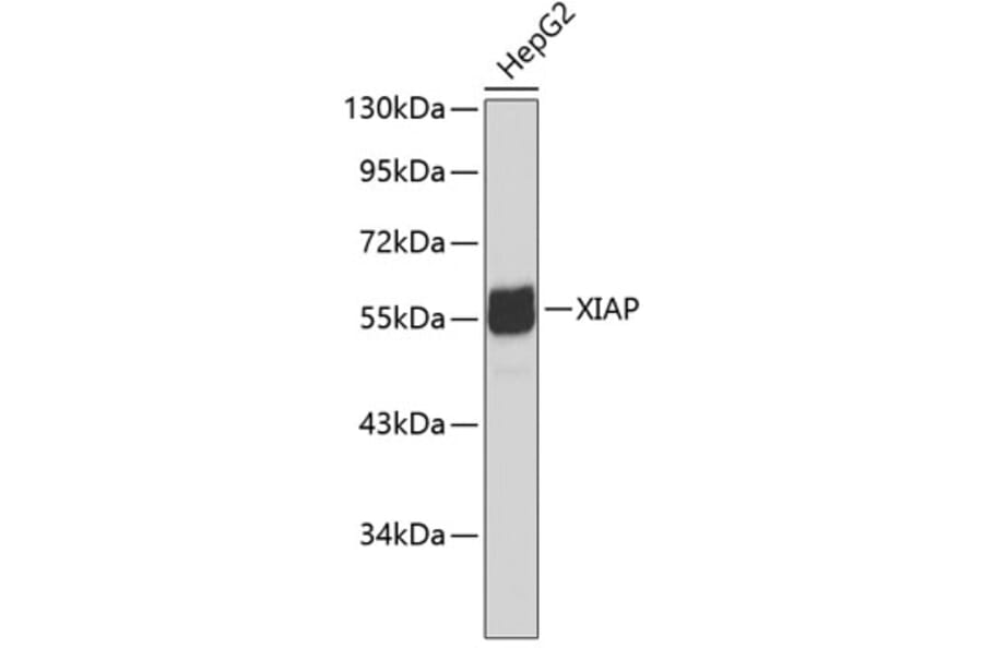 Western Blot - Anti-XIAP Antibody (A0383) - Antibodies.com