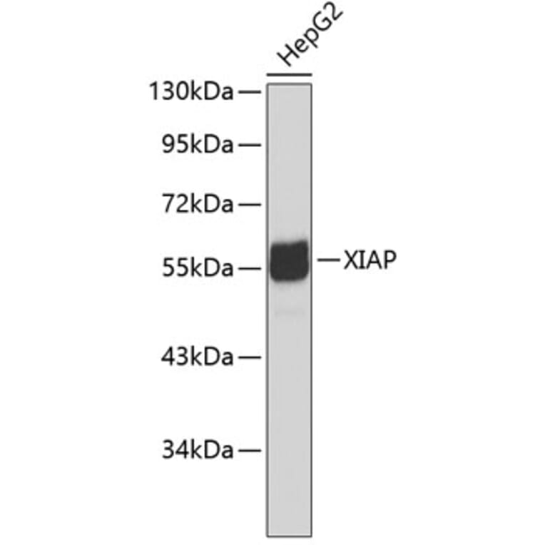 Western Blot - Anti-XIAP Antibody (A0383) - Antibodies.com