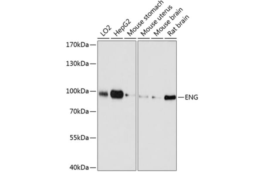 Western Blot - Anti-ENG Antibody (A0391) - Antibodies.com