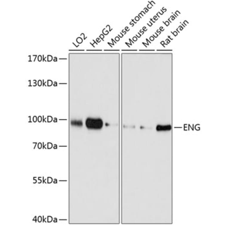 Western Blot - Anti-ENG Antibody (A0391) - Antibodies.com
