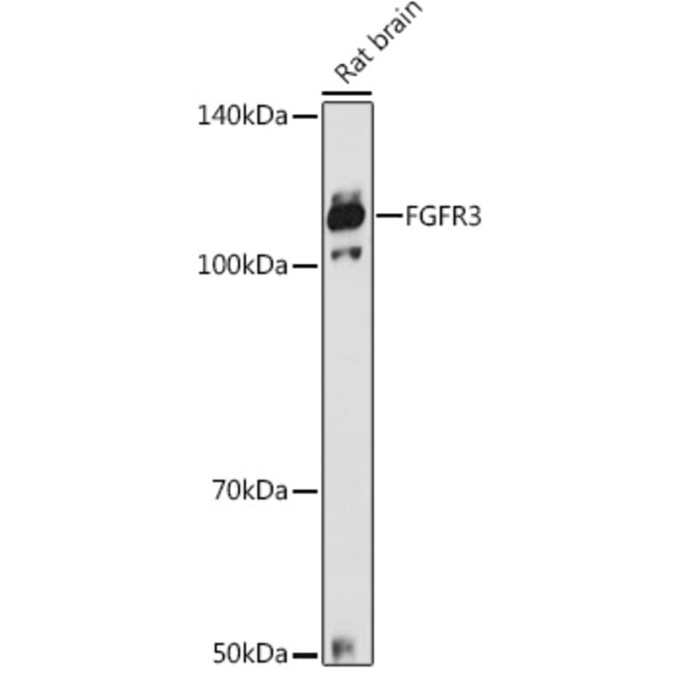 Western Blot - Anti-FGFR3 Antibody (A8397) - Antibodies.com