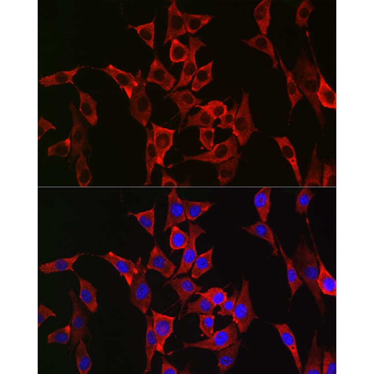 Immunofluorescence - Anti-FGFR3 Antibody (A8397) - Antibodies.com