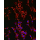 Immunofluorescence - Anti-FGFR3 Antibody (A8397) - Antibodies.com