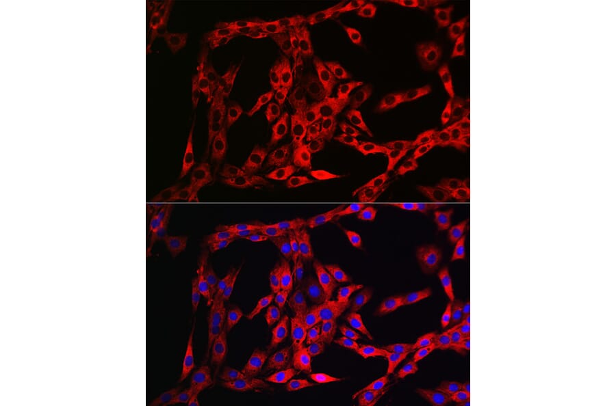 Immunofluorescence - Anti-FGFR3 Antibody (A8397) - Antibodies.com