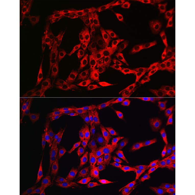 Immunofluorescence - Anti-FGFR3 Antibody (A8397) - Antibodies.com