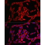 Immunofluorescence - Anti-FGFR3 Antibody (A8397) - Antibodies.com