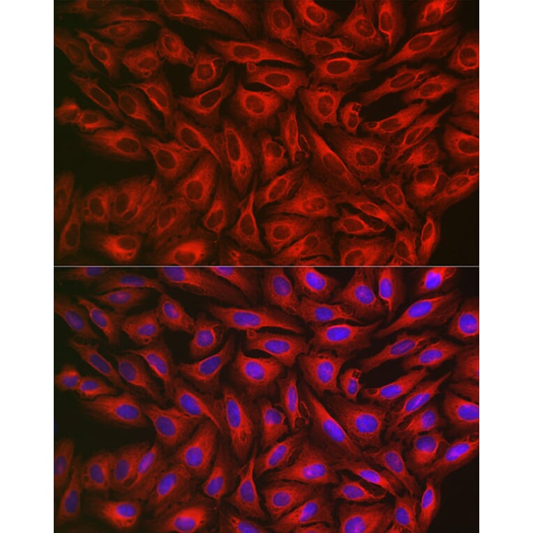 Immunofluorescence - Anti-FGFR3 Antibody (A8397) - Antibodies.com