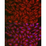 Immunofluorescence - Anti-FGFR3 Antibody (A8397) - Antibodies.com