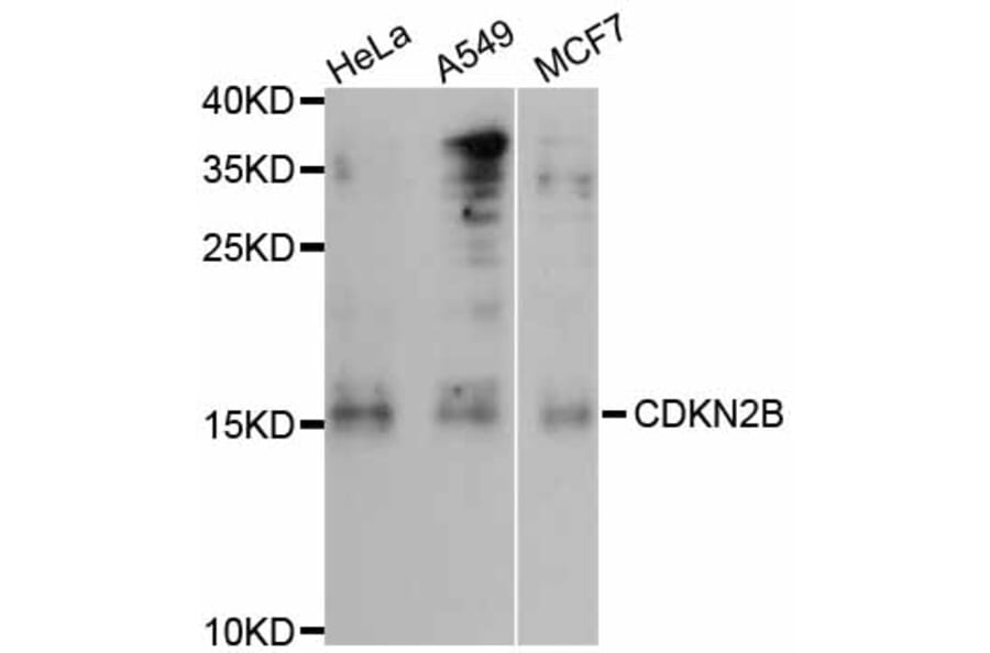 Western Blot - Anti-CDKN2B Antibody (A0406) - Antibodies.com