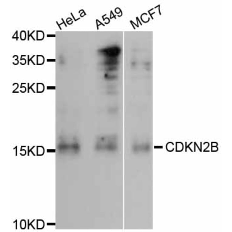 Western Blot - Anti-CDKN2B Antibody (A0406) - Antibodies.com