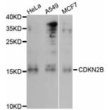 Western Blot - Anti-CDKN2B Antibody (A0406) - Antibodies.com