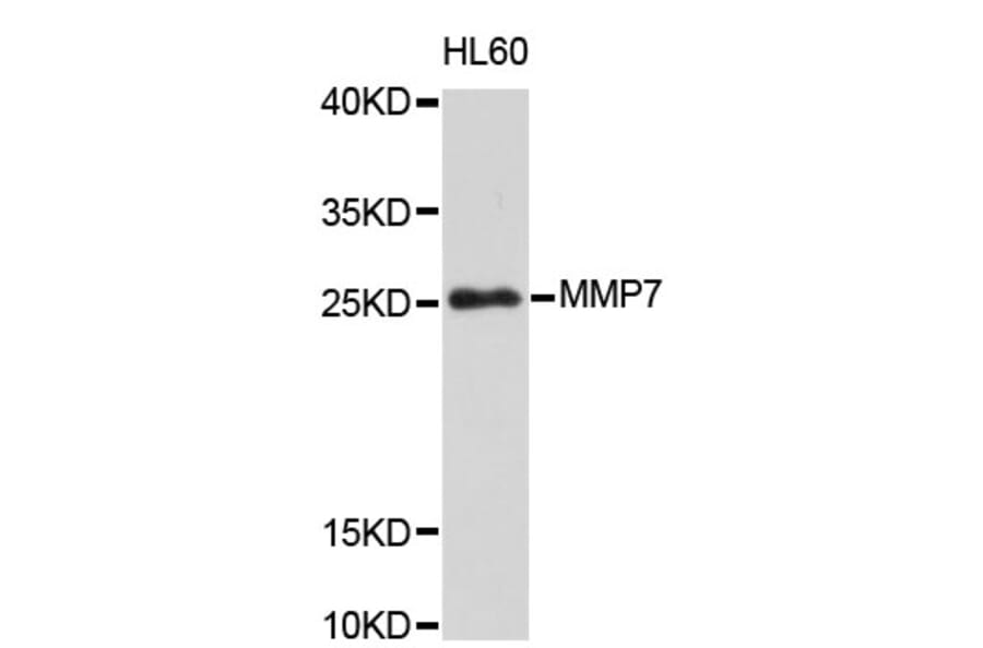 Western Blot - Anti-MMP7 Antibody (A0410) - Antibodies.com
