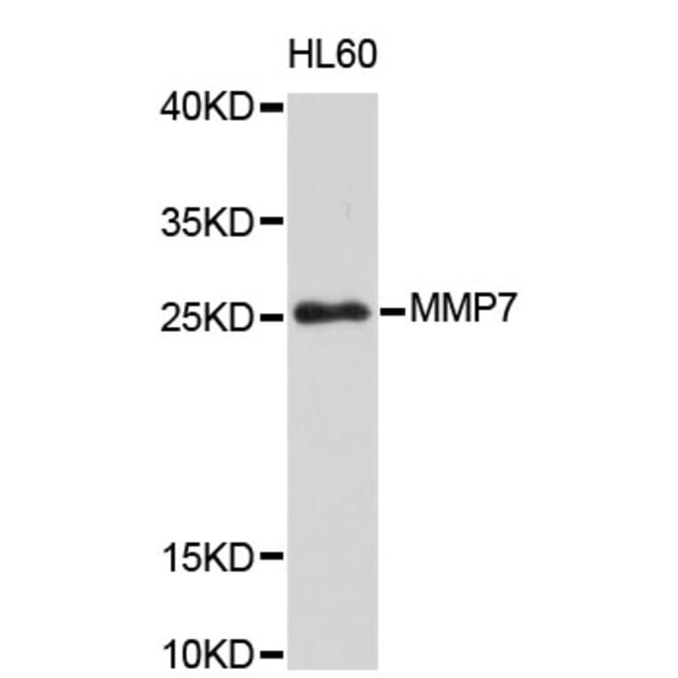 Western Blot - Anti-MMP7 Antibody (A0410) - Antibodies.com