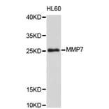 Western Blot - Anti-MMP7 Antibody (A0410) - Antibodies.com
