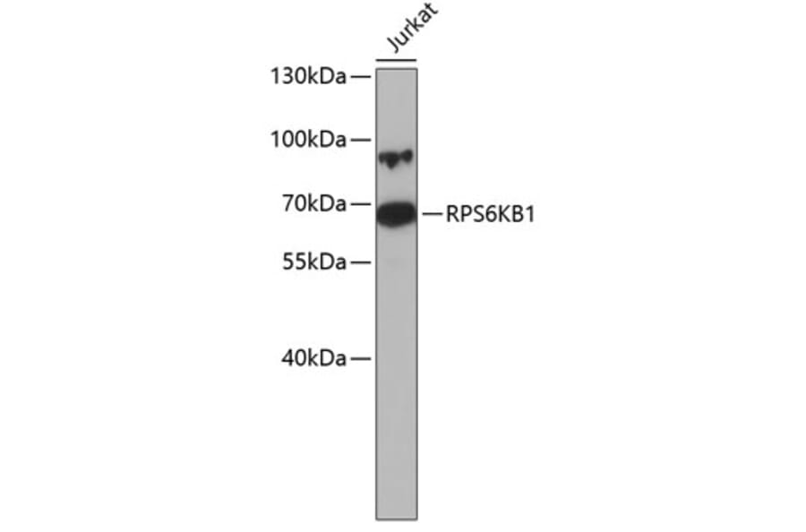 Western Blot - Anti-RPS6KB1 Antibody (A0446) - Antibodies.com