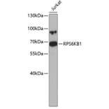 Western Blot - Anti-RPS6KB1 Antibody (A0446) - Antibodies.com