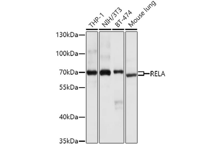 Western Blot - Anti-RELA Antibody (A0450) - Antibodies.com