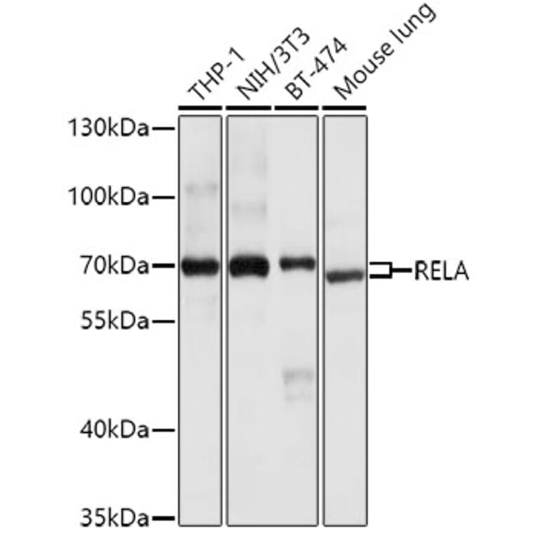 Western Blot - Anti-RELA Antibody (A0450) - Antibodies.com